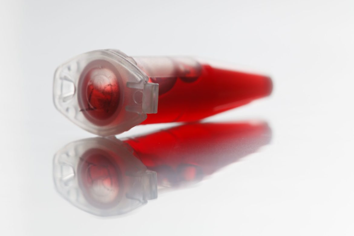 Ein Plastikröhrchen gefüllt mit rotem Blut.
