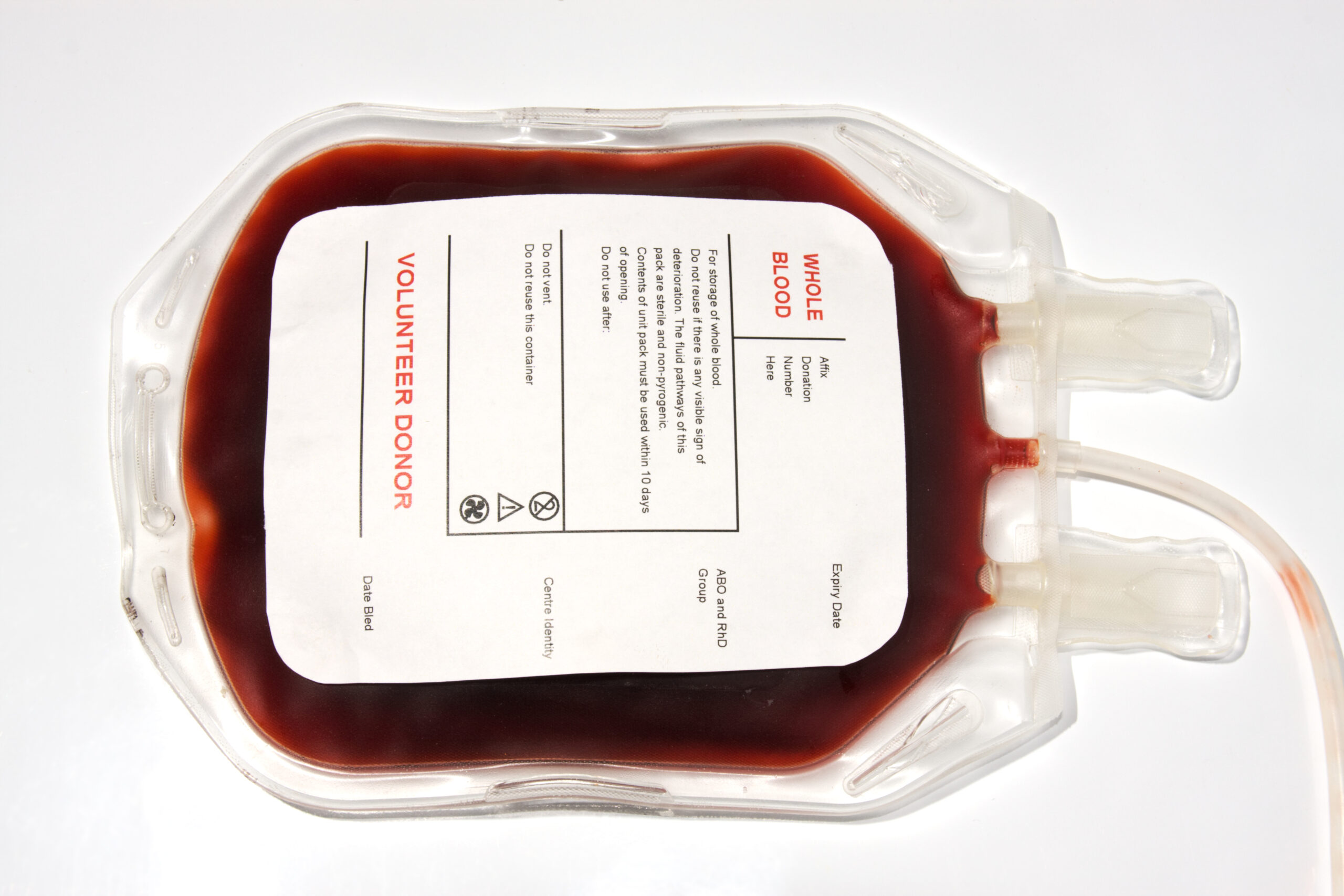 Eine Bluttransfusion von einem Spender