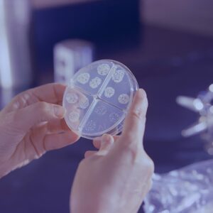 Antibiotikaresistenz vermeiden_Hände halten Petrischale im Labor