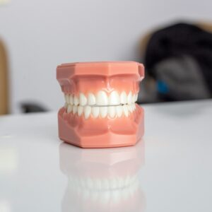 ursache zahnfleischrückgang: Modell eines Gebisses